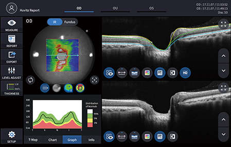 Qizlar qinni yalaydilar